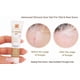 thumbnail image 2 of Crema De Silicona Para Cicatrices 10 G Con Vitamina E, 2 of 8