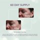 thumbnail image 3 of Almohadillas de silicona para ojos SilcSkin, reutilizables durante 60 días, 3 of 8