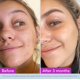thumbnail image 3 of Tónico Facial Good Molecules Niacinamida 120 ml, 3 of 9