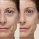 thumbnail image 4 of Prebase Peter Thomas Roth Pack de 2 × 30 ml, 4 of 8
