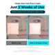 thumbnail image 4 of Suero WELLAGE Hyper PDRN Repair 30 ml Anti-Edad, 4 of 7