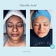 thumbnail image 3 of Chemical Peel Perfect Image con ácido glicólico 30% con retinol, 30 ml, 3 of 9