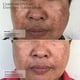 thumbnail image 4 of Crema de Retinol Sente 30 ml Tono y Textura Uniformes, 4 of 9