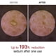thumbnail image 3 of Peeling Ampoule Dr.Melaxin Peel Shot Glow White Rice 80mL, 3 of 3