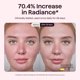 thumbnail image 5 of Máscara facial LED wavytalk de terapia con luz roja – Rosa, 5 of 9