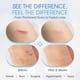 thumbnail image 4 of Parches para cicatrices ScarScience Advanced Medical Silicone, 12 tiras, 4 of 7