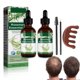 thumbnail image 1 of Aceite de Romero Para Crecimiento del Cabello 60ml con Peine, 1 of 3
