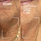 thumbnail image 2 of Crema para reafirmar el cuello Dr. Brandt Needles No More, 50 g x 2, 2 of 8