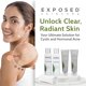 thumbnail image 5 of Kit de tratamiento para el acné Exposed Skin Care Basic con ácido salicílico, 5 of 6