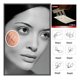 thumbnail image 5 of Sutura Adhesiva Deroyal Para Cierre De Heridas  Poliamida Blanca Blanco, 5 of 6
