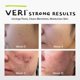 thumbnail image 3 of Sistema Skincare VERI de óxido nítrico y ácido salicílico para limpiar la piel, 3 of 6