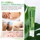 thumbnail image 5 of Gel Queloide para eliminar cicatrices Tobcharm Advanced 30 ml, 5 of 6