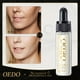 thumbnail image 3 of 15ml Golden Hyaluronic Acid Moisturizing Serum: Reduce the Appearance of Aging Wrinkles!, 3 of 4