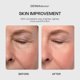 thumbnail image 5 of Limpiador Facial DERMAdoctor 210 ml Ácido Glicólico Antiarrugas, 5 of 8