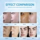 thumbnail image 3 of Serum despigmentante Praiveue con niacinamida 30 ml, 3 of 8