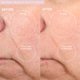 thumbnail image 4 of Kit de Exfoliación Facial y Corporal en Casa Microderm PMD Beauty, 4 of 9