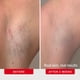 thumbnail image 4 of Pads para vellos encarnados First Aid Beauty BHA AHA 28 unidades, 4 of 9
