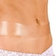 thumbnail image 3 of Cinta De Tratamiento De Cicatrices Newgel Advanced Silicone, 3 of 9
