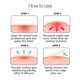 thumbnail image 3 of Parches para espinillas OLIVE YOUNG Care Plus Spot, paquete de 1 (102 unidades), 3 of 7