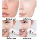 thumbnail image 5 of Crema Facial AIFEG Black Bandage Antiarrugas 60 g, 5 of 6
