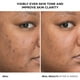 thumbnail image 2 of Suero IT Cosmetics Bye Bye Dark Spots 4% Niacinamida 30 ml, 2 of 3