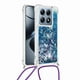 thumbnail image 5 of Funda FOXDOCK para Xiaomi 14T Pro con Cuerda Ajustable, Brillo Líquido, Protección Antigolpes y Lente – Ideal para Regalo, 5 of 6