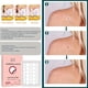 thumbnail image 3 of 144 Miracle Invisible Hydrocolloid Patches - Say Goodbye to Acne & Blemishes!, 3 of 4