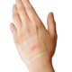 thumbnail image 5 of Bandages Curad Soothe & Cool Burn, enfriamiento instantáneo, 8 unidades, 5 of 5