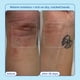 thumbnail image 5 of Crema para aliviar las manos Skinfix reduce el enrojecimiento, 90 ml, piel seca, 5 of 8