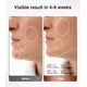 thumbnail image 2 of Máscara de Terapia de Luz Roja Jovs Rostro, 2 of 3
