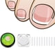 thumbnail image 1 of Tiras correctoras para uñas encarnadas (50/100 unidades), parches correctores para uñas curvadas, pinzas para enderezar y recuperar uñas encarnadas, para hombres y mujeres, cuidado de los pies., 1 of 6
