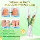 thumbnail image 2 of Pluma de tratamiento para uñas ONIADBA 6×5 ml de alta potencia, 2 of 6