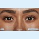 thumbnail image 5 of Parches para debajo de los ojos NuFace IonPlex Hydra-Gel Power (60 unidades), 5 of 8