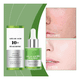 thumbnail image 4 of Serum Facial Antiacne Acido Azelaico 10% + Hialuronico 30ml, 4 of 9