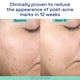 thumbnail image 5 of Sérum Cetaphil, suave y transparente, reparador para después del acné, 30 ml, Bakuchiol, 5 of 8