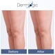 thumbnail image 3 of Crema Con Vitamina K Hidratante Para Curar Moretones, 3 of 8