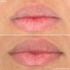 thumbnail image 5 of Tratamiento Labial RescueMD Restorativo 12 ml, 5 of 8