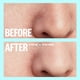 thumbnail image 2 of Tiras minimizadoras de poros PEACE OUT Skincare con retinol y vitamina A, 2 of 9