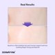 thumbnail image 2 of Mascarilla facial Dermafirm, gel tonificante y reparador calmante R4, 4 unidades, 2 of 8