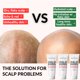 thumbnail image 2 of Hidratante para cuero cabelludo The Bald Brothers 90 ml (2 unidades), 2 of 6