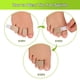 thumbnail image 4 of Enderezadores De Dedos Up Grade Hammer Toe Paquete De 12, 4 of 7
