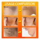 thumbnail image 5 of Jabon Kojic Acid Barra Acido Kojico Blanqueador Anti Acne 1u 100gr, 5 of 6