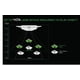 thumbnail image 5 of Accesorio Nyko Zoom para Kinect Xbox 360, 5 of 7