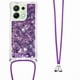 thumbnail image 1 of Funda FOXDOCK para Xiaomi Redmi Note 13 4G con Cuerda Ajustable, Brillo Líquido, Protección Antigolpes y Lente – Ideal para Regalo, 1 of 6