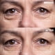 thumbnail image 3 of Parches para el contorno de ojos contra arrugas de silicona médica Wrinkles Schminkles, 3 of 8