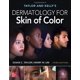 thumbnail image 1 of Libro McGraw-Hill Education Dermatología: Piel de Color, 1 of 1