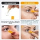 thumbnail image 4 of [Paquete de 12] Herramienta amarilla para insertar y retirar lentes esclerales Twizz, 4 of 5