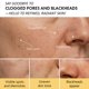 thumbnail image 5 of Mascarilla Facial de Arcilla Caliente Roseblem 140 g para Poros Profundos, 5 of 8