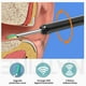 thumbnail image 3 of Endoscope Earpick Wireless Smart Visual Ear Cleaner Stick for Earwax Remover Otoscope Mini Camera Personal Health Care Set Gift, 3 of 3