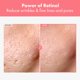 thumbnail image 2 of Crema NATUREKIND Repair Retinol al 0,1% con Bakuchiol 50 g, 2 of 7